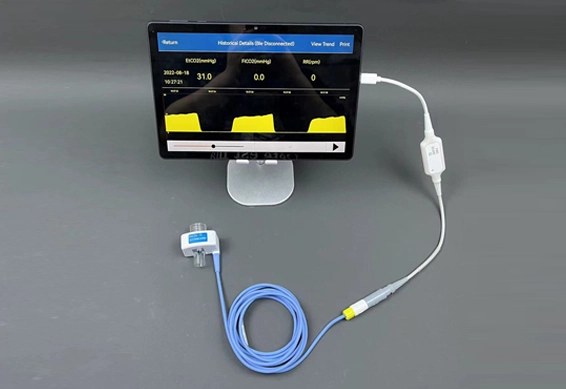 capnography end tidal co2 monitoring